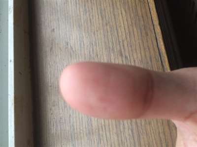 大拇指因皮肤褶皱造成了一道很深的横纹，会影响手机指纹识别吗？