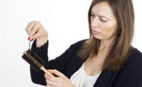 脂溢性脱发并非男性专利 关于它你了解多少呢