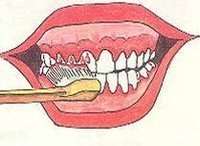 刷牙时，牙龈老是出血是怎么回事？在线等！