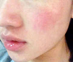 表妹现在在肇庆那边工作，说最近化妆后面上红痒，不知道是不是过敏？
